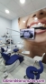 Fotos del anuncio: Se traspasa clinica dental y esttica 