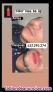 Fotos del anuncio: Aumento de labios cido hialuronico 150