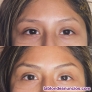 Fotos del anuncio: Micropigmentacion y Microblading